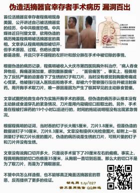 伪造活摘器官幸存者手术病历 漏洞百出